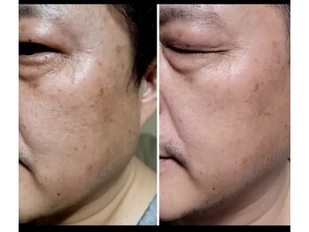 ジェイアンドエス トータルビューティー(J&S Total Beauty)/【★くすみ改善♪フェイシャル】