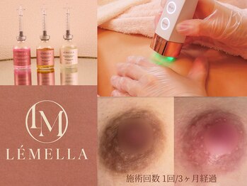 グランカリス(GRAND CHARIS)の写真/【施術は1回のみ】韓国シェアNo.1メラニンケア『ルメラ』で黒ずみを集中ケア☆「やって満足」の声多数!!