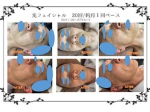 磨凛/光フェイシャル