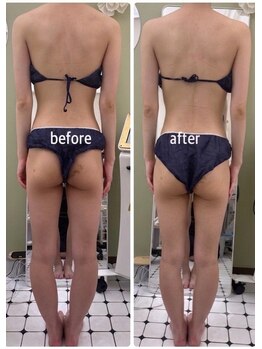 グランルリエ(Gran Rurier)の写真/【即実感】脚が細く、長く見えるようになる！骨格矯正とエナジー＋アップで圧倒的効果を体験★