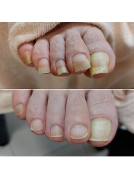 爪切り屋 足楽/踏ん張れます