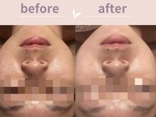 アール(R)/フェイシャルプラン