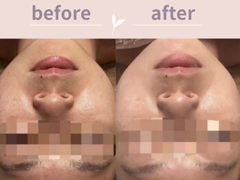 アール(R)/フェイシャルプラン