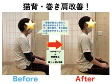 八乙女マイル接骨院/長年のお悩みとおさらば！