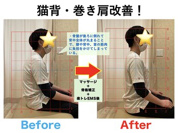 八乙女マイル接骨院/長年のお悩みとおさらば！