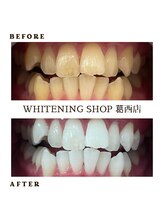 ホワイトニングショップ 葛西店/ホワイトニング専門店