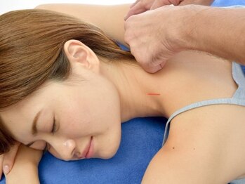 一番町はりきゅう院の写真/長年続く「頭痛」「肩こり」『盛上ってしまった肩』「腰痛」「自律神経の乱れ」などにお悩みの方必見です！