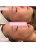【超特価】小顔・毛穴たるみケア 韓国発サーマルリフト全顔¥22,000→¥11,000