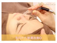エステ ココ 荻窪店(Esthe CoCo)の雰囲気（人気NO1の☆毛穴タイプ別コース★肌質改善フェイシャル★）