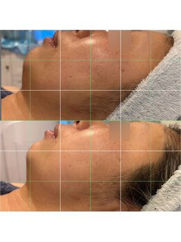 マシロ(MA SHIRO)/オールハンドマッサージ+EMS