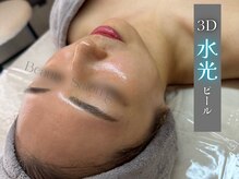 グロウ(glow.)の雰囲気（3D水光ピール施術直後）