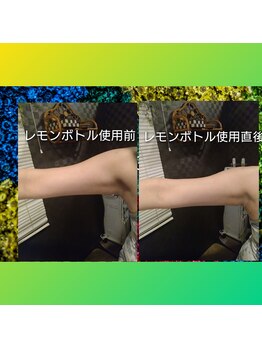 リラクゼーションサロン アールズ(R's)/韓国最新美容★レモンボトル