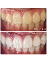 ホワイトニングルーム 横浜店(Whitening Room)/セルフホワイトニング/横浜