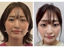 mano【小顔矯正/リンパマッサージ/筋膜リリース】の雰囲気(小顔矯正10回/3ヶ月【福岡/薬院/小顔矯正/小顔/骨盤矯正】)