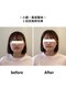 ぷめはな整体の写真/フェイスラインのたるみ、原因は表情筋・頭蓋骨・姿勢の歪み。根本から整える小顔ケア