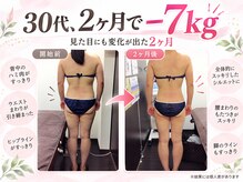 さがみ鍼灸整骨院の雰囲気（産後の体型を元に戻す）