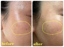 ベルドア(Bell Door)/【シミケア】