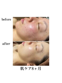 エステティックレイビス 弘前店(RAYVIS)/