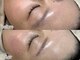 クレール(CLAIR)の写真/美容液成分たっぷりのWAXでぷるぷるツヤ肌に♪お客様のお悩みを改善し、透明感のある美肌に導きます◎