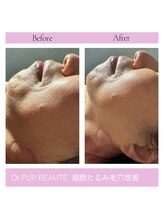 エムビューティークリニック(M beauty clinic)/年齢肌でたるみでお悩みの方