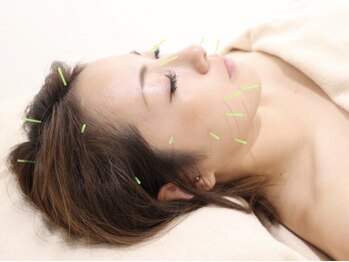 モリタ鍼灸整骨院の写真/【美肌リフトフェイシャル×全身美容鍼】東洋医学の力で内側から根本改善！￥7,900