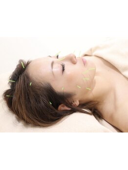 鍼灸施術を受けたい