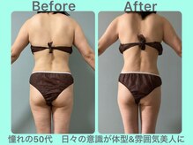 ビーナイス ビューティー(Be Nice Beauty)/メンテナンス☆ 美BODY☆ 50代