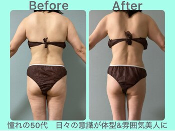 ビーナイス ビューティー(Be Nice Beauty)/メンテナンス☆ 美BODY☆ 50代