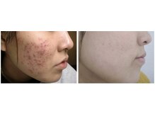 スリリアン 銀座/★お客さまビフォーアフター★