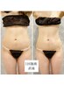 【新規女性/年齢を重ねた“痩せにくい“に】筋膜リリース全身痩身90分¥9900