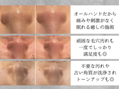 ホイップスパ(WHIP SPA)の写真