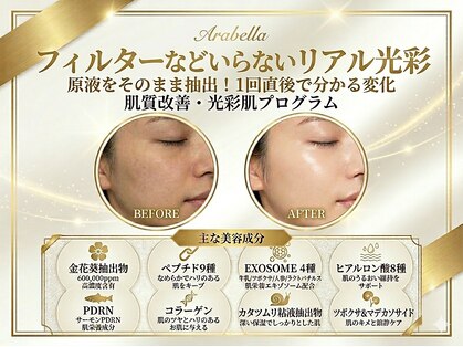 アラベラ(AraBella)の写真