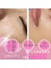 【毛穴洗浄+光フォト脱毛60分】　根本的に毛穴レス叶えるセット　￥6,000
