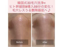 アスボーテ 月島(As Beaute’)の雰囲気（韓国式3D毛穴洗浄で毛穴汚れを徹底除去!+イオンザイム導入効果UP）