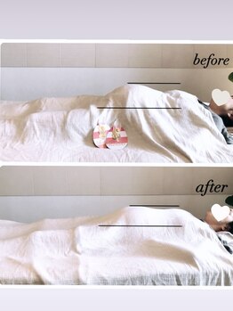 エッセンスマム 東京 プレナタールサロン(Prenatal salon)/そけい部や恥骨のいたみなく