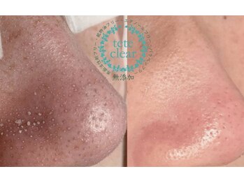 ジェリー(JERRY)/詰まりがなくなると