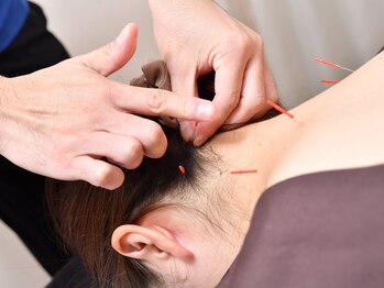 大砂土治療院/首・肩こりへの鍼灸施術