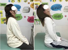 藤接骨院 藤枝警察署前院/真上を向けない首の痛みが楽に♪