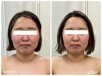 サロンディト(ditto)/【施術1回】小顔コルギ+カスマラ