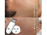 毛穴レスキュー＋ヒゲ脱毛＋美肌パック