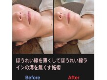 美容矯正サロン レレポノ(LELEPONO)/