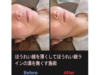 美容矯正サロン レレポノ(LELEPONO)/