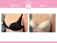 デミーナ(Demyna)/