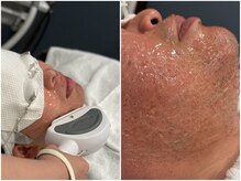 ケリーズ(KELLY `S)の雰囲気（スキンケア髭脱毛でお客様の美肌づくりをサポートしています。）