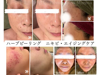 ミモザ(Mimosa)の写真