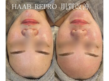 シェア(share.)/HAAB REPRO 