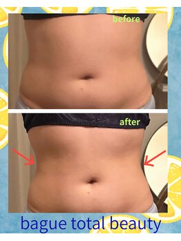 バーグトータルビューティー(bague total beauty)/レモンボトルでくびれを作る！