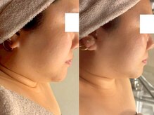 ビュウナ 銀座(BEAUNA)/カルテットモード/フェイシャル