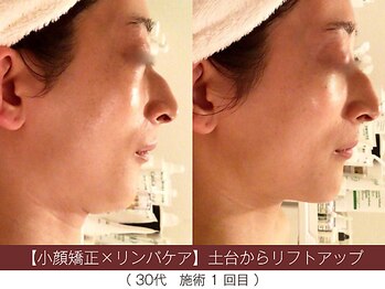 ホワイトカメリア(White Camellia)の写真/【栄｜久屋大通】初期のたるみ・ほうれい線から深刻なたるみ刻まれたほうれい線まで全て解決いたします。