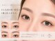 アチャ(accha)の写真